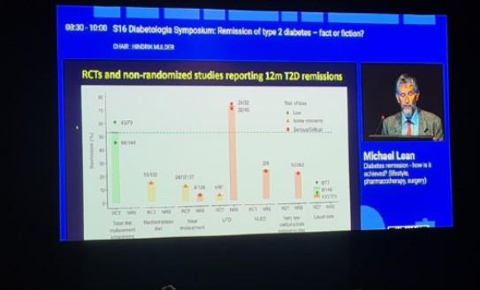 A photo of a projector screen at the EASD conference with Professor Roy Taylor presenting his research findings on the stage